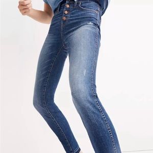Madewell 10” Button Fly High Rise Skinny Jeans Sz 28